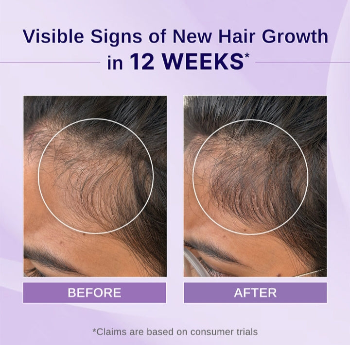 Lofe Beauty Hair Growth Serum